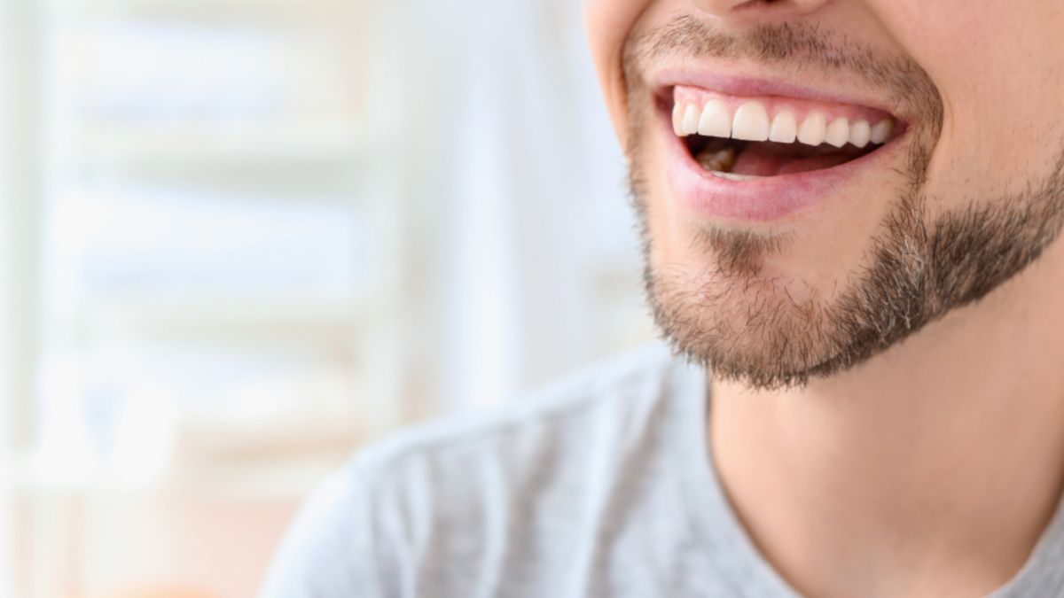 A man smiling broadly, showing off his brilliant smile thanks to teeth whitening.