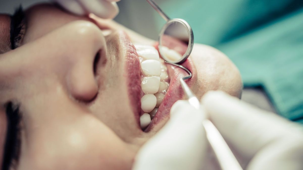 A woman undergoing a teeth cleaning procedure at Smiles Dentistry, highlighting the importance of oral health.