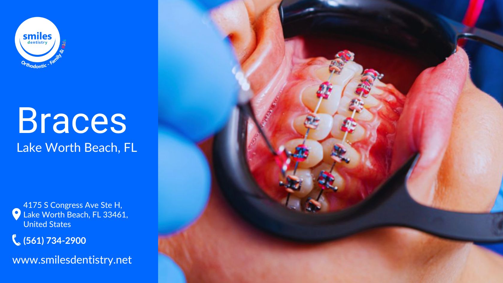 An orthodontist in blue gloves adjusts a patient's metal braces with colorful brackets on the upper teeth.