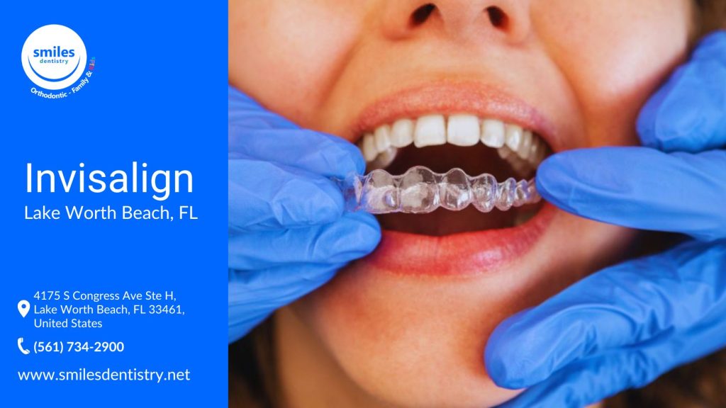 A smiling person receives a clear Invisalign aligner from a dental professional wearing blue gloves and gently placing it over their upper teeth.