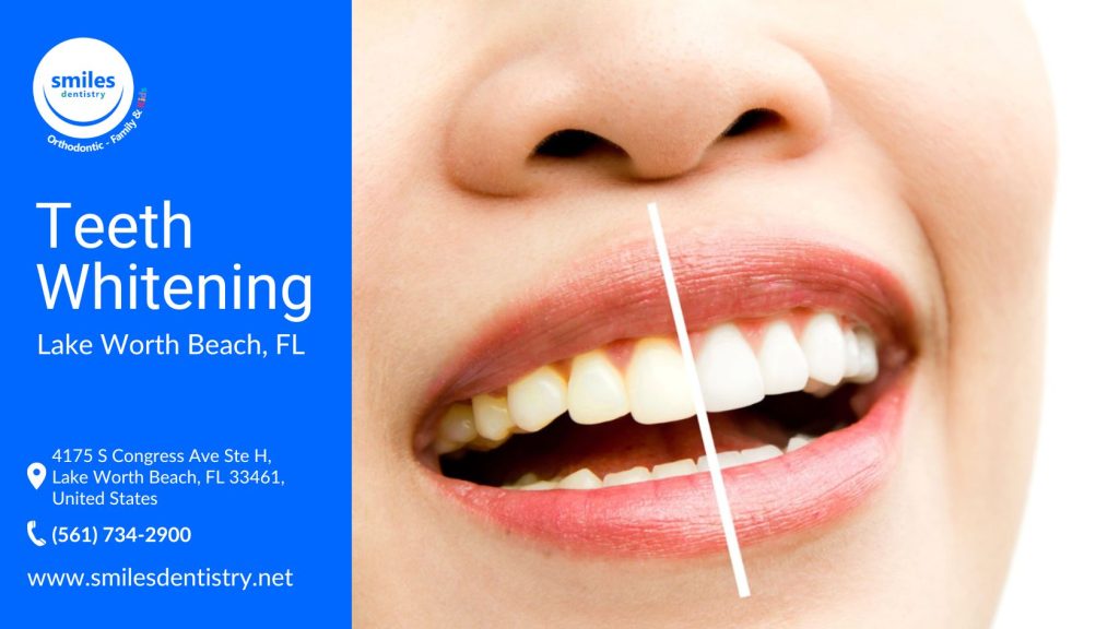 A woman smiling after a professional teeth whitening treatment.