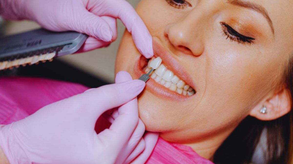 A cosmetic dentist compares tooth shades to match veneers for a smiling female patient.