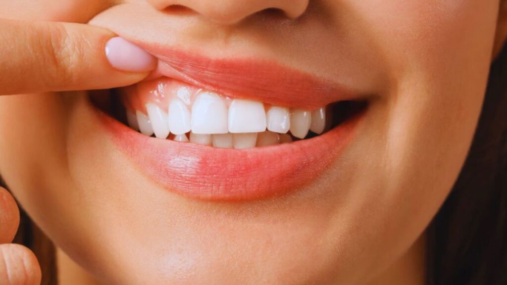 Smiling woman with an attractive smile, hands on her face, exuding joy and warmth.
