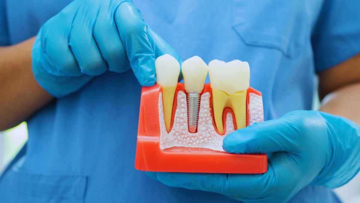 A dental professional wearing blue scrubs and blue gloves holds a cross-sectional model of teeth and gums, illustrating the concept of root canals and dental restoration.