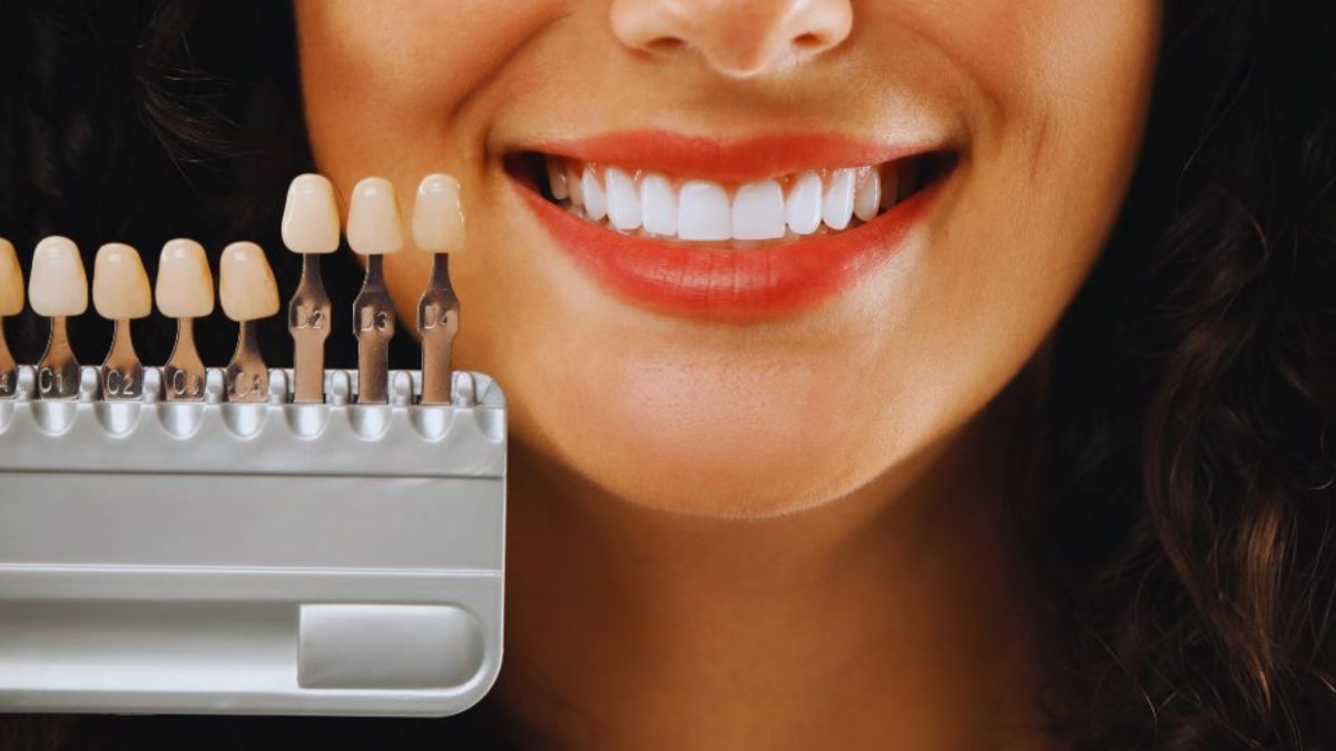 A smiling woman shows bright white teeth, holding a dental shade guide next to her mouth to compare different crown colors.